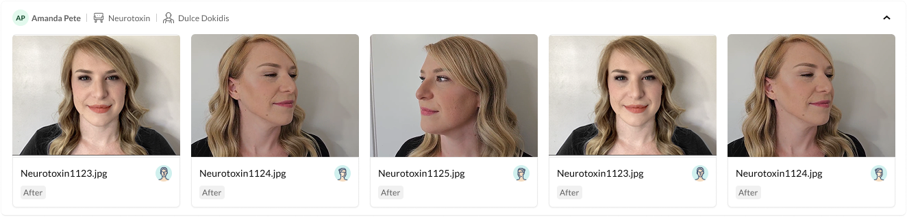 Cuadrícula de la galería de fotos