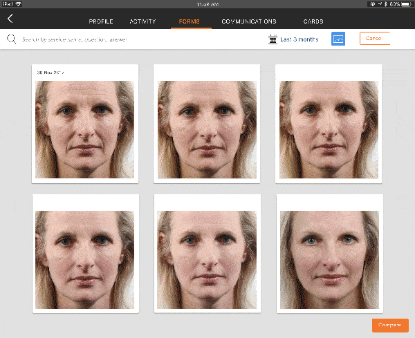 Using before and after pictures for sales and marketing